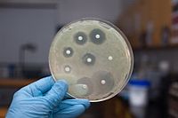 מחקר חדש מנסה לענות על השאלה: האם יש קשר בין השימוש בתרופות וטרינריות לעמידות חיידקים פתוגנים בבני אדם ?