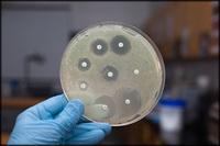 מלחמת החיידקים: מחקרים של האוניברסיטה העברית