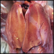 אירועי דלקת כבד עם גופיפי הסגר בצפון הארץ