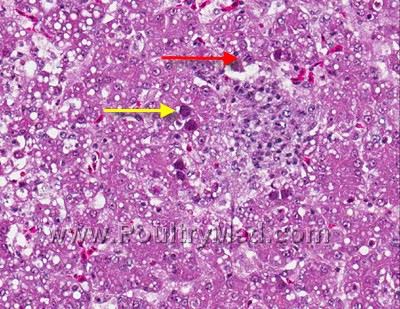 Inclusion Body Hepatitis
