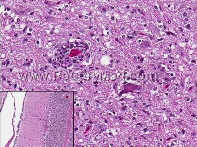 histology Avian Encephalomyelitis