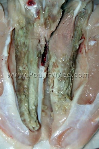 Deep pectoral myopathy