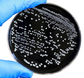 קמפילובקטר - האם מחלה תעסוקתית ?